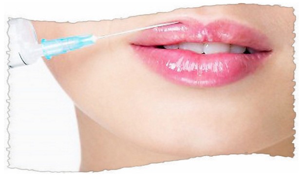 Больно ли увеличивать губы филлерами с гиалуроновой кислотой