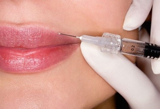 Можно ли убрать гиалуроновую кислоту из губ