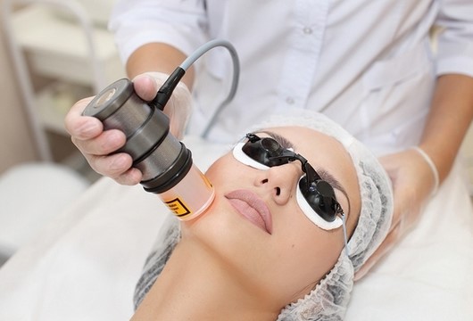 Лазерная биоревитализация кожи лица гиалуроновой кислотой 